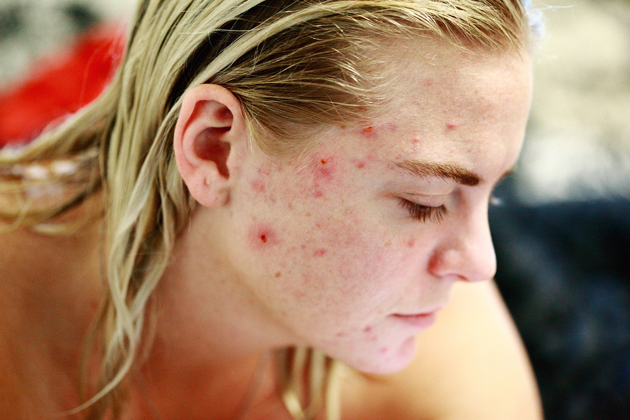 what is toxin in human body
